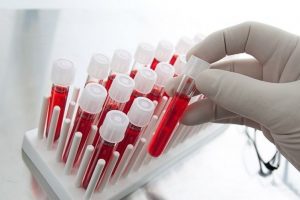 exame-de-paternidade-dna-de-sangue 3