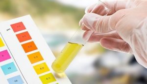 exame-toxicologico-de-urina 3