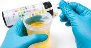 onde-encontro-exame-toxicologico-de-urina 3