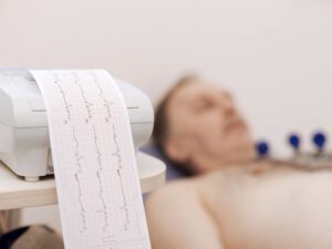 exames complementares eletrocardiograma lab sao vicente